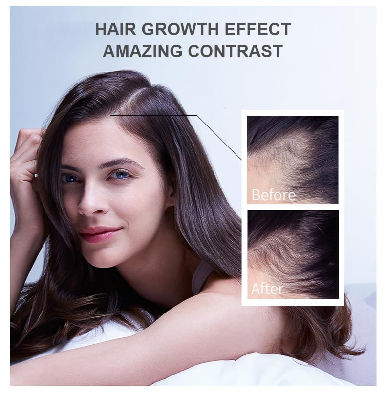 Hair Growth Oil Ginger Biotin  - مراجعة Epidermal Growth Factor وسعره