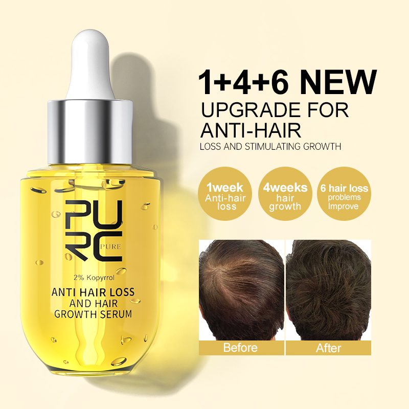 PURC Hair Growth Serum for Men - مراجعة Epidermal Growth Factor وسعره
