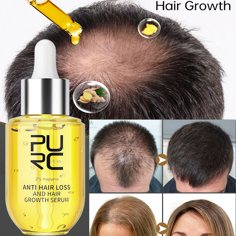 PURC Hair Growth Serum for Men - مراجعة Epidermal Growth Factor وسعره
