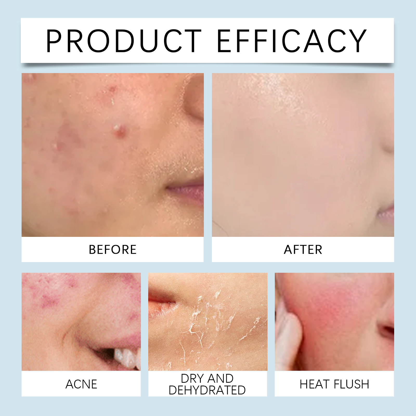 Hydrating roller Serum 0.25mm  - مراجعة Luxury Skincare Serum وسعره