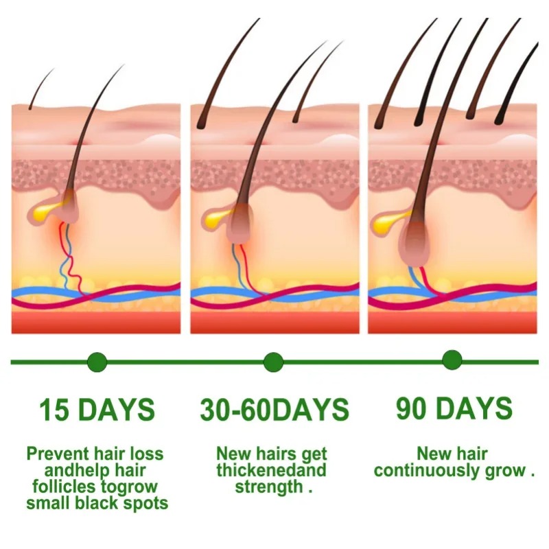 Hair Growth Serum Fast Growing - مراجعة Epidermal Growth Factor وسعره