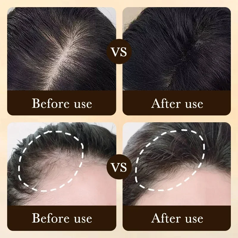 Biotin fast Hair Growth oil Pr - مراجعة Epidermal Growth Factor وسعره