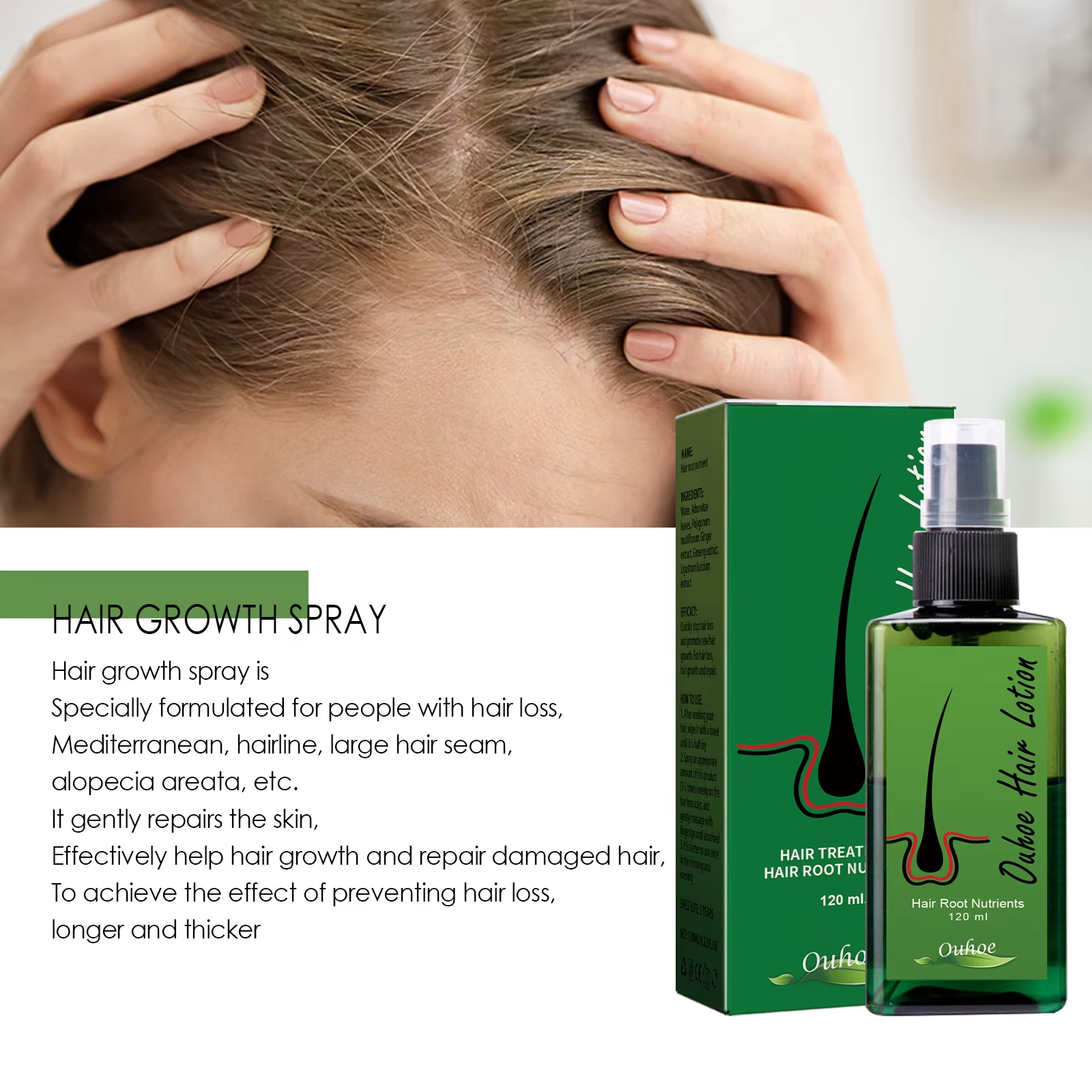 Hair Growth Spray Anti Hair Lo - مراجعة Epidermal Growth Factor وسعره