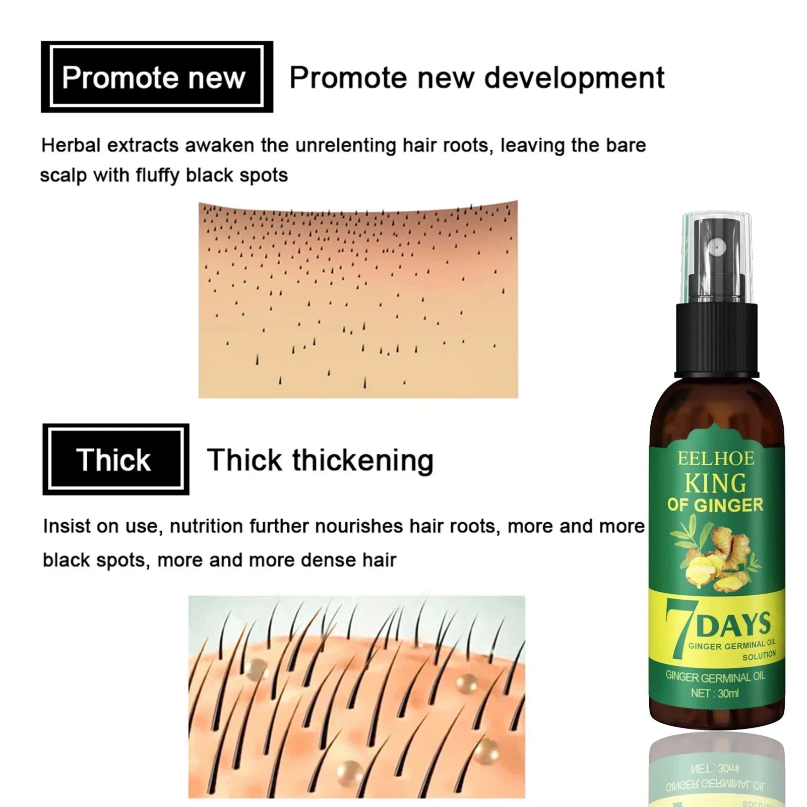 2024 Ginger Hair Growth Serum  - مراجعة Epidermal Growth Factor وسعره