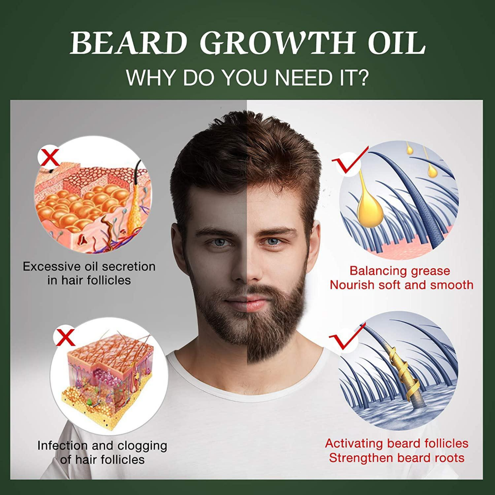 Fast Beard Growth Oil Beard Oi - مراجعة Epidermal Growth Factor وسعره