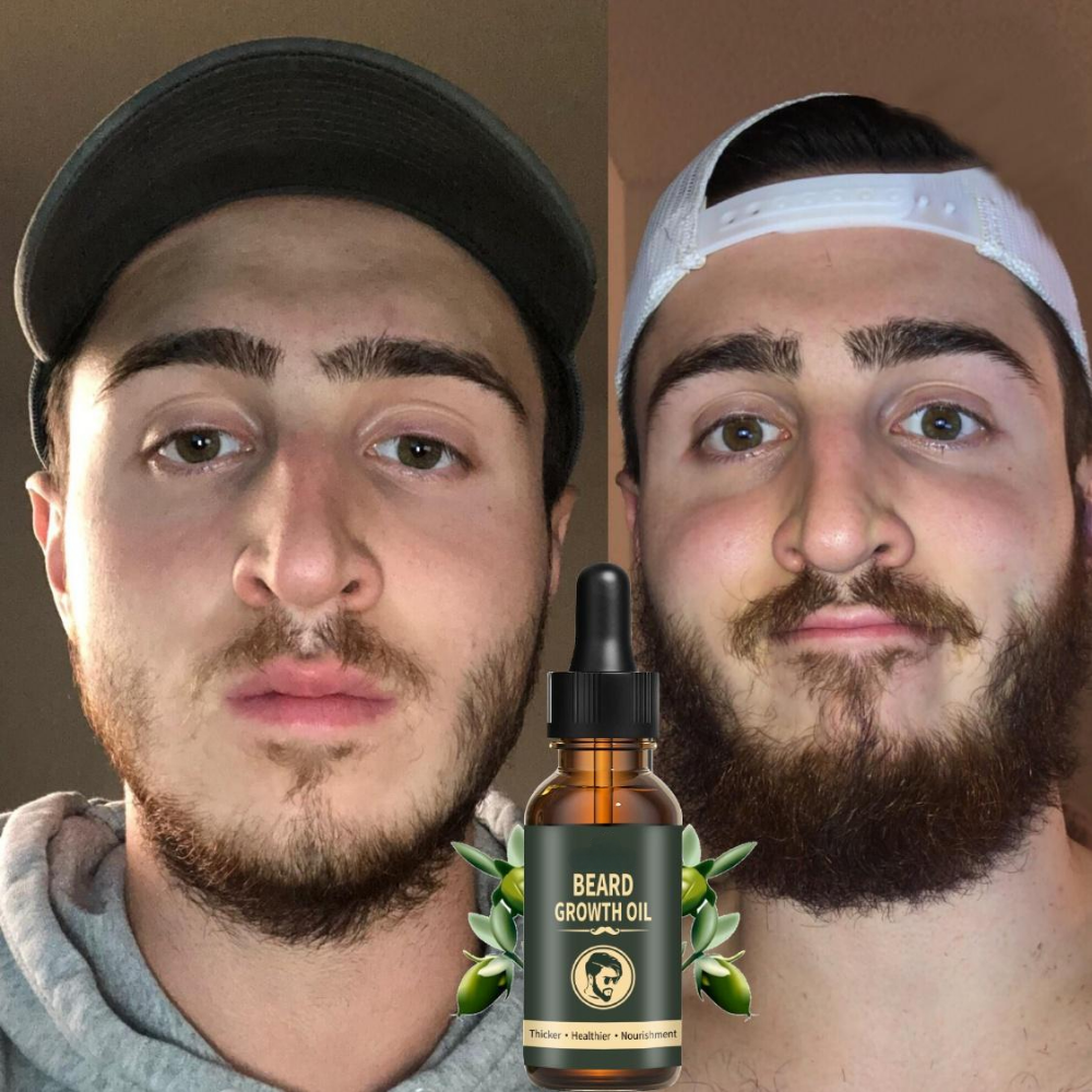Fast Beard Growth Oil Beard Oi - مراجعة Epidermal Growth Factor وسعره